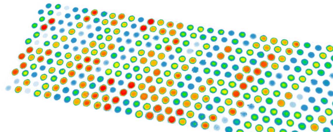 Cambridge Protein Arrays